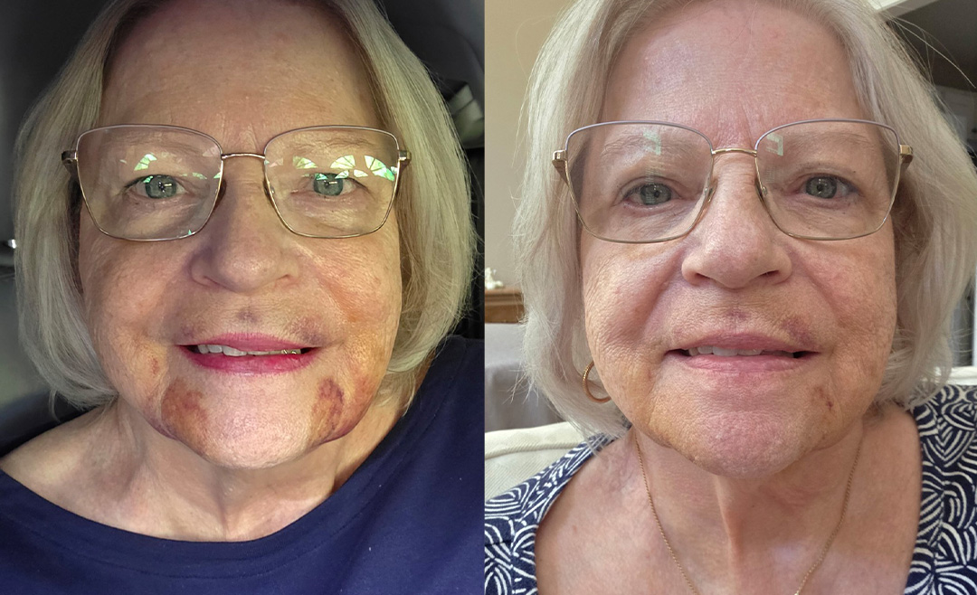 Before & After